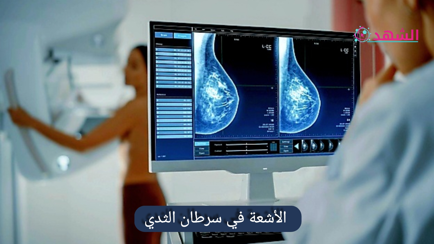 الأشعة في سرطان الثدي
