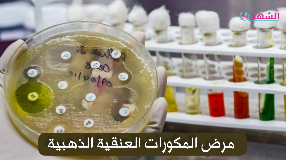 مرض المكورات العنقية الذهبية